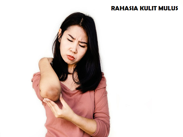 Kulit Kasar di Area Siku dan Lutut